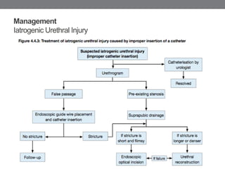 Urethral Trauma | PPTX