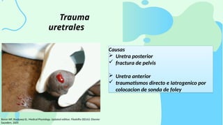 Comprehensive Overview of Urogenital Trauma: Diagnosis and Treatment | PPTX