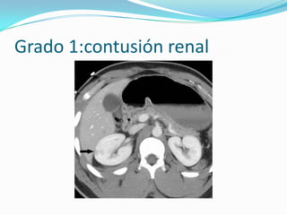 DIAGNOSTICOEcografía: útil durante el seguimiento de los pacientes en fase de recuperación. RMN y la gammagrafía son técnicas de imagen de segunda línea. Angiografía para el diagnóstico y embolización selectiva de lesiones vascularessangrantes.