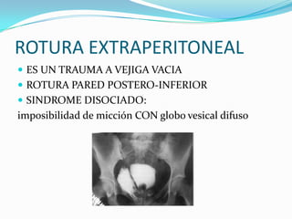 Dolor abdominal difuso y dolor abdominal a la palpación