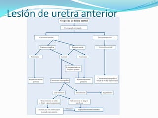 DISURIA o IMPOSIBILIDAD PARA ORINAR