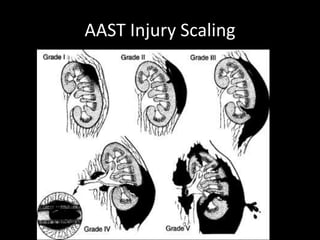 AAST Injury Scaling
 