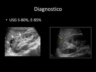 Diagnostico
• USG S-80%, E-85%
 