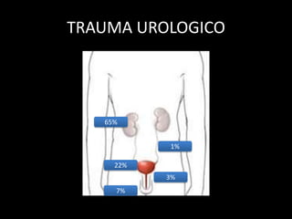 TRAUMA UROLOGICO




   65%


           1%

     22%
           3%
     7%
 
