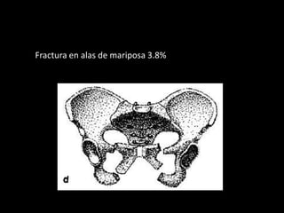 Fractura en alas de mariposa 3.8%
 