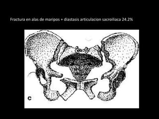 Fractura en alas de maripos + diastasis articulacion sacroiliaca 24.2%
 