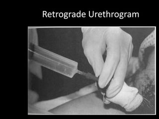 Retrograde Urethrogram
 