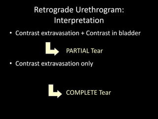 Retrograde Urethrogram:
             Interpretation
• Contrast extravasation + Contrast in bladder

                   PARTIAL Tear
• Contrast extravasation only



                   COMPLETE Tear
 
