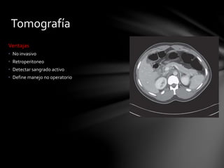 Tomografía
Ventajas
• No invasivo
• Retroperitoneo
• Detectar sangrado activo
• Define manejo no operatorio
 