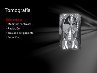 Tomografía
Desventajas
• Medio de contraste.
• Radiación.
• Traslado del paciente.
• Sedación.
 