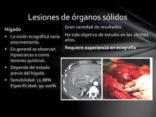 Lesiones de órganos sólidos
Gran variedad de resultados
Ha sido objetivo de estudio en los últimos
años.
Requiere experiencia en ecografía
Hígado
• La visión ecográfica varía
enormemente.
• En general se observan
hipoecoicas o como
lesiones quísticas.
• Depende del estado
previo del hígado.
• Sensibilidad: 15-88%
Especificidad: 99-100%
 