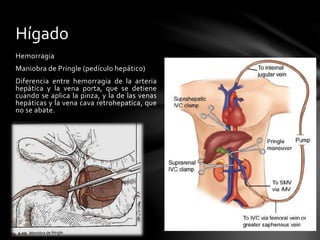 Hemorragia
Maniobra de Pringle (pedículo hepático)
Diferencia entre hemorragia de la arteria
hepática y la vena porta, que se detiene
cuando se aplica la pinza, y la de las venas
hepáticas y la vena cava retrohepatica, que
no se abate.
Hígado
 