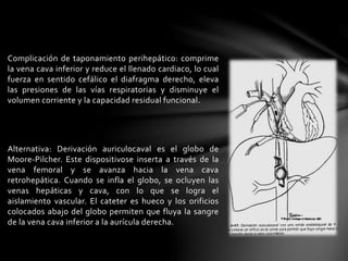 Complicación de taponamiento perihepático: comprime
la vena cava inferior y reduce el llenado cardiaco, lo cual
fuerza en sentido cefálico el diafragma derecho, eleva
las presiones de las vías respiratorias y disminuye el
volumen corriente y la capacidad residual funcional.
Alternativa: Derivación auriculocaval es el globo de
Moore-Pilcher. Este dispositivose inserta a través de la
vena femoral y se avanza hacia la vena cava
retrohepática. Cuando se infla el globo, se ocluyen las
venas hepáticas y cava, con lo que se logra el
aislamiento vascular. El cateter es hueco y los orificios
colocados abajo del globo permiten que fluya la sangre
de la vena cava inferior a la aurícula derecha.
 