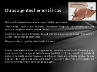 Goma de fibrina para laceraciones superficiales y profundas…
*Reacciones anafilacticas mortales, hipotensión idiopática relacionadas con una
reacción antigénica al componente bovino.
Sutura del parénquima hepático: Catgut crómico 2-0 o 1-0 con aguja roma curva y
grande, con puntos de colchonero.
Hepatotomía con ligadura selectiva de los vasos
Lesión transhepática: Globo intrahepatico, se hace atando un dren de Penrose grande
a un cateter hueco y ligar el extremo opuesto del dren. A continuación se inserta el
globo en la herida con hemorragia y se infla con medio de contraste soluble. Se usa
una llave de 3 vías o una pinza para ocluir el cateter y conservar la insuflación. Se
extrae en una operación posterior de 24 a 48hrs.
Otros agentes hemostáticos
 