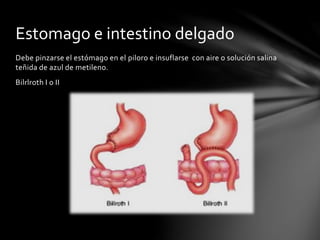 Debe pinzarse el estómago en el piloro e insuflarse con aire o solución salina
teñida de azul de metileno.
Bilrlroth I o II
Estomago e intestino delgado
 