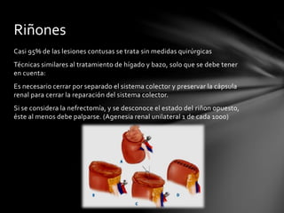 Casi 95% de las lesiones contusas se trata sin medidas quirúrgicas
Técnicas similares al tratamiento de hígado y bazo, solo que se debe tener
en cuenta:
Es necesario cerrar por separado el sistema colector y preservar la cápsula
renal para cerrar la reparación del sistema colector.
Si se considera la nefrectomía, y se desconoce el estado del riñon opuesto,
éste al menos debe palparse. (Agenesia renal unilateral 1 de cada 1000)
Riñones
 