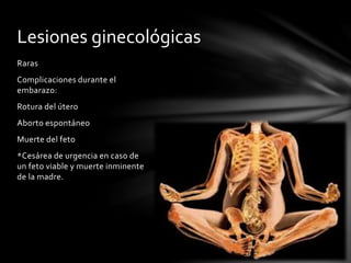 Raras
Complicaciones durante el
embarazo:
Rotura del útero
Aborto espontáneo
Muerte del feto
*Cesárea de urgencia en caso de
un feto viable y muerte inminente
de la madre.
Lesiones ginecológicas
 