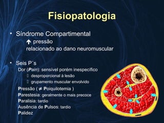 Fisiopatologia
• Síndrome Compartimental
        pressão
       relacionado ao dano neuromuscular

• Seis P´s
   Dor (Pain): sensível porém inespecífico
        desproporcional à lesão
        grupamento muscular envolvido
   Pressão ( ≠ Poiquilotemia )
   Parestesia: geralmente o mais precoce
   Paralisia: tardio
   Ausência de Pulsos: tardio
   Palidez
 