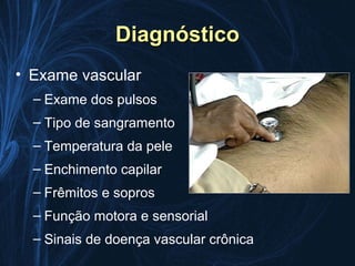 Diagnóstico
• Exame vascular
  – Exame dos pulsos
  – Tipo de sangramento
  – Temperatura da pele
  – Enchimento capilar
  – Frêmitos e sopros
  – Função motora e sensorial
  – Sinais de doença vascular crônica
 