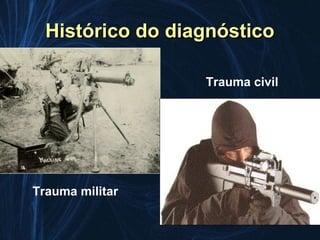 Histórico do diagnóstico

                  Trauma civil




Trauma militar
 