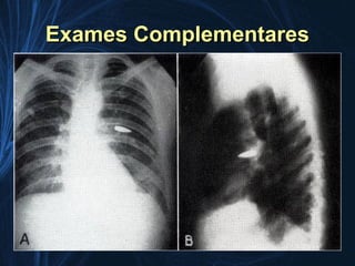 Exames Complementares
 