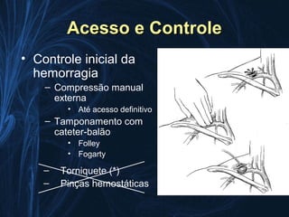 Acesso e Controle
• Controle inicial da
  hemorragia
    – Compressão manual
      externa
         • Até acesso definitivo
    – Tamponamento com
      cateter-balão
         • Folley
         • Fogarty

    –   Torniquete (*)
    –   Pinças hemostáticas
 