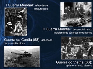 I Guerra Mundial: infecções e
                    amputações




                          II Guerra Mundial: desenvolvimento
                                   incipiente de técnicas e trabalhos

Guerra da Coréia (58): aplicação
de novas técnicas




                                     Guerra do Vietnã (66):
                                             aprimoramento técnico
 