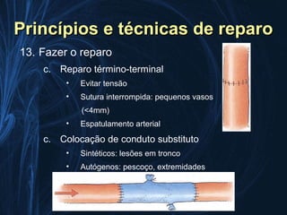 Princípios e técnicas de reparo
13. Fazer o reparo
    c. Reparo término-terminal
         •   Evitar tensão
         •   Sutura interrompida: pequenos vasos
             (<4mm)
         •   Espatulamento arterial
    c. Colocação de conduto substituto
         •   Sintéticos: lesões em tronco
         •   Autógenos: pescoço, extremidades
         •   Discussão: femoral superficial e subclávia
 