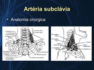 Artéria subclávia
• Anatomia cirúrgica
 