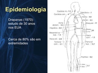 Epidemiologia
Drapanas (1970):
estudo de 30 anos
nos EUA


Cerca de 80% são em
extremidades
 
