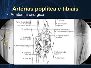 Artérias poplítea e tibiais
• Anatomia cirúrgica
 