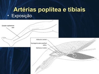 Artérias poplítea e tibiais
• Exposição
 