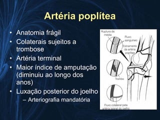 Artéria poplítea
• Anatomia frágil
• Colaterais sujeitos a
  trombose
• Artéria terminal
• Maior índice de amputação
  (diminuiu ao longo dos
  anos)
• Luxação posterior do joelho
    – Arteriografia mandatória
 