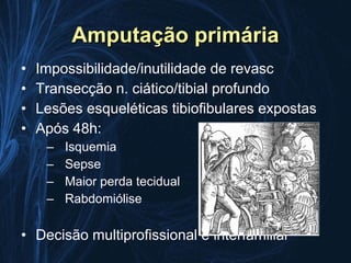 Amputação primária
•   Impossibilidade/inutilidade de revasc
•   Transecção n. ciático/tibial profundo
•   Lesões esqueléticas tibiofibulares expostas
•   Após 48h:
     –   Isquemia
     –   Sepse
     –   Maior perda tecidual
     –   Rabdomiólise

• Decisão multiprofissional e interfamiliar
 
