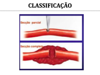 CLASSIFICAÇÃO
 