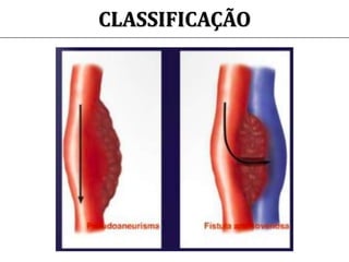 CLASSIFICAÇÃO
 