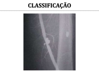 CLASSIFICAÇÃO
 