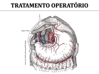TRATAMENTO OPERATÓRIO
 