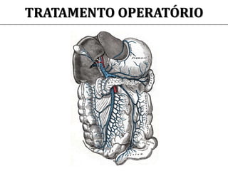 TRATAMENTO OPERATÓRIO
 