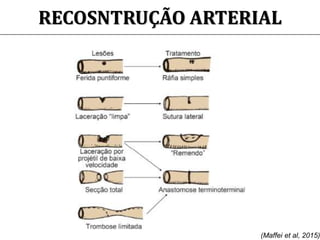 RECOSNTRUÇÃO ARTERIAL
(Maffei et al, 2015)
 