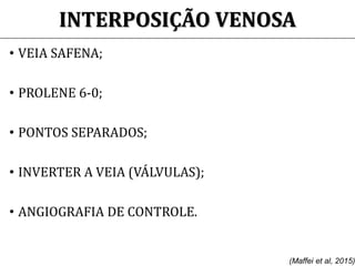 INTERPOSIÇÃO VENOSA
• VEIA SAFENA;
• PROLENE 6-0;
• PONTOS SEPARADOS;
• INVERTER A VEIA (VÁLVULAS);
• ANGIOGRAFIA DE CONTROLE.
(Maffei et al, 2015)
 