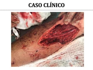 CASO CLÍNICO
 