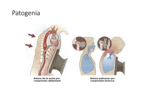 Patogenia
 