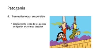 Patogenia
4. Traumatismo por suspensión
• Cizallamiento lento de los puntos
de fijación anatómica vascular
 