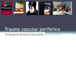 Trauma vascular periferico
Dr Respardo Ramirez Carlos R2Cg
 