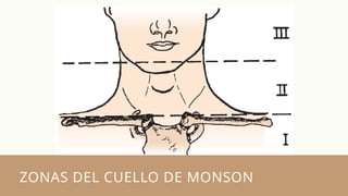 ZONAS DEL CUELLO DE MONSON
 