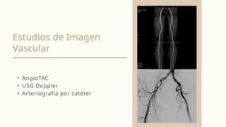 Estudios de Imagen
Vascular
• AngioTAC
• USG Doppler
• Arteriografía por catéter
 