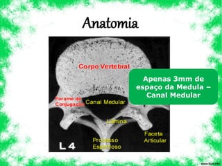 Anatomia
Apenas 3mm de
espaço da Medula –
Canal Medular
 