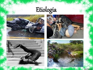 Etiologia
 