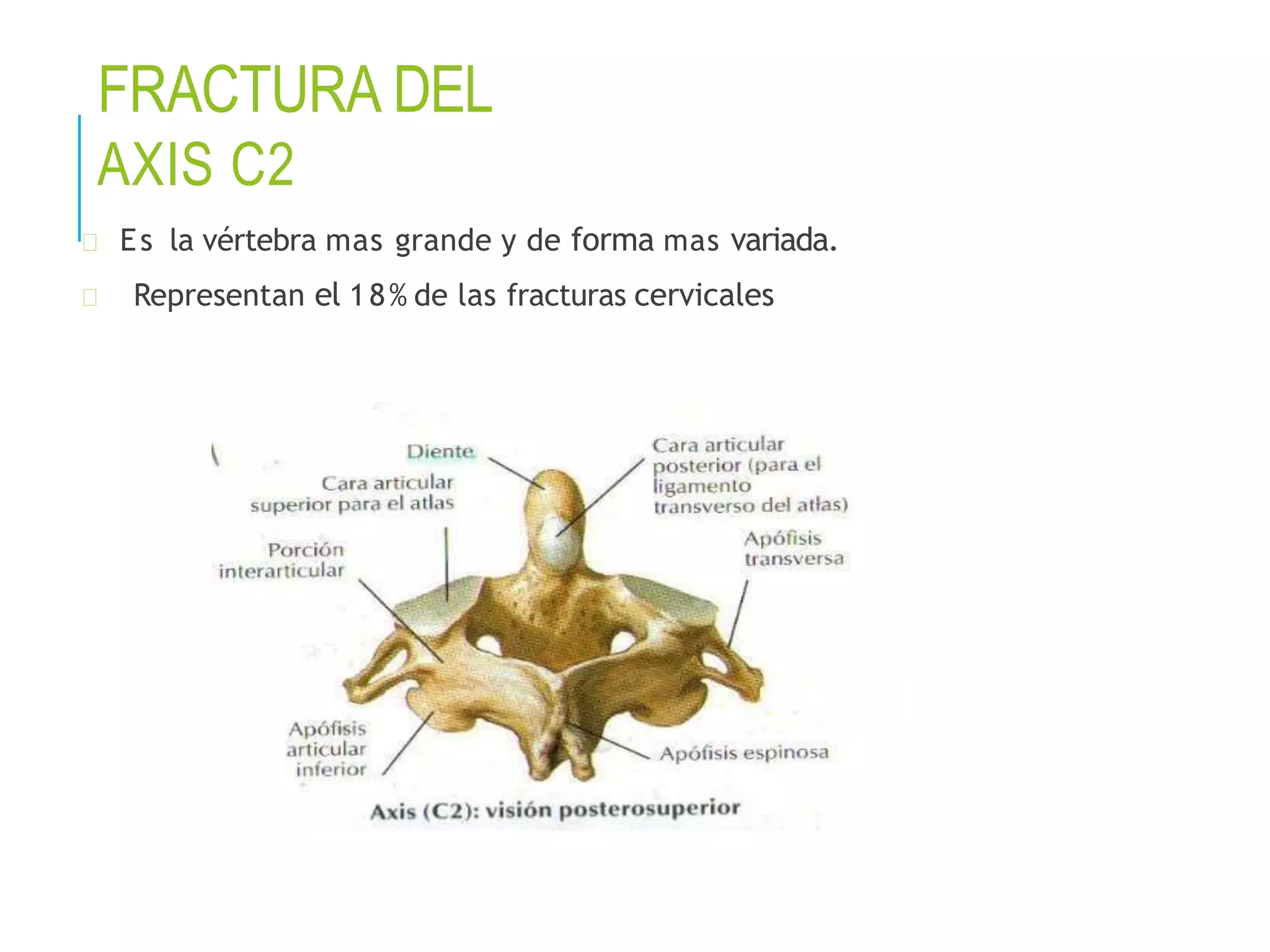Vertebrogram TRAUMA VERTEBRO MEDULAR.pptx | Death, Injury, or Military Conflict ...